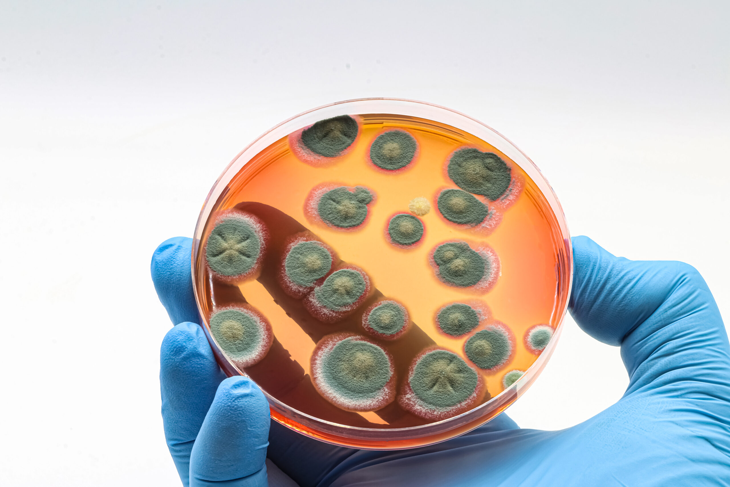 Microbiological culture with a colonies of Fungi, mold.